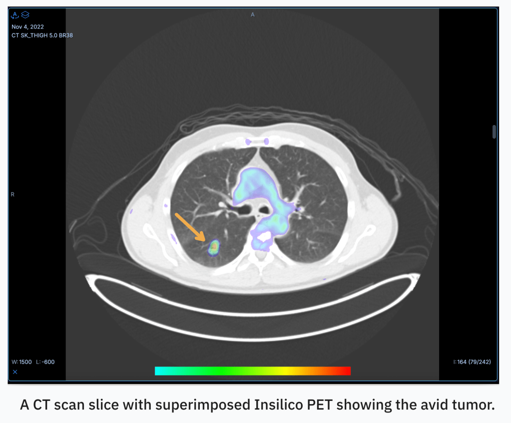 Excited to see RadicAI’s AI-driven diagnostic imaging solutions